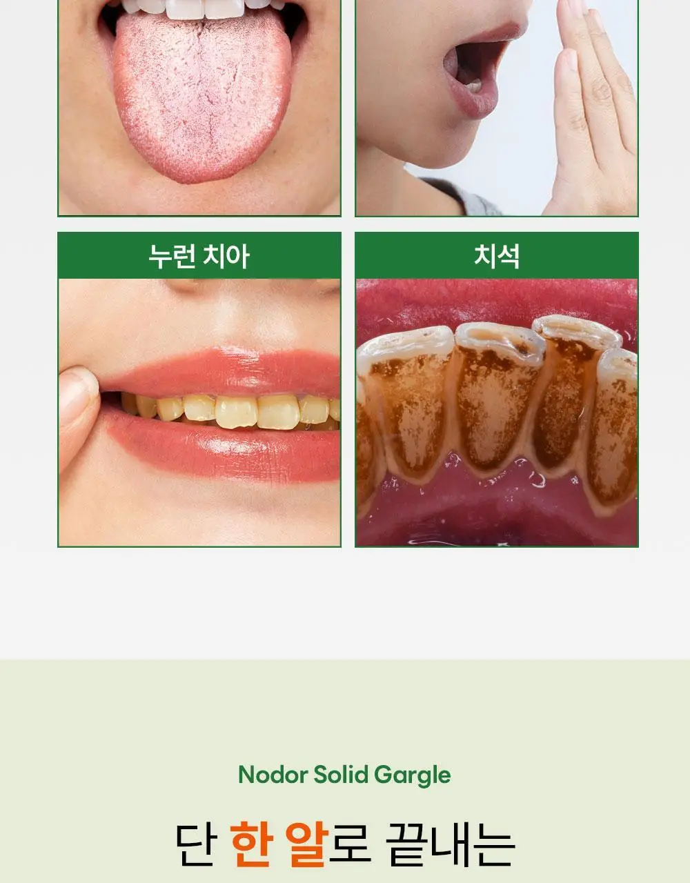 [불소 포함] 노도르 고체가글 30정 상세페이지 9